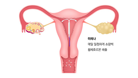 호르몬루프(미레나, 카일리나, 제이디스)