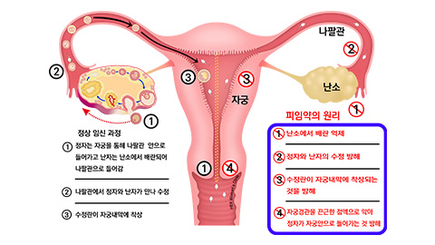 경구용 피임약